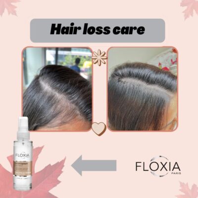 FLOXIA فلوكسيا سيروم علاج تساقط الشعر وتقليل ترققه.يعزز بصيلات الشعر وتقوية الجذور.يساعد على زيادة ثبات الشعر وكثافته واعادة انبات البصيلات وتحفيزها في 12 اسبوع