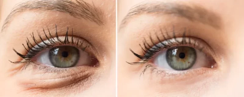 SKINCEUTICALS سكن سيوتيكالز جل العين لتقليل ظهور علامات الشيخوخة حول العينين. يحتوي على مزيج من مضادات الأكسدة التي تساعد على حماية البشرة من أضرار الجذور الحرة