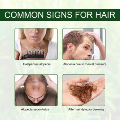 زيت إكليل الجبل زيت أساسي طبيعي يعد علاجًا فعّالًا لمشاكل تساقط الشعر وتطويل الرموش