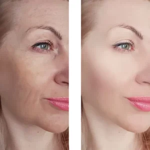 Alternative view of BRUNOVASSARI برونوفازاري كيانتي لشد التجاعيد KIANTY