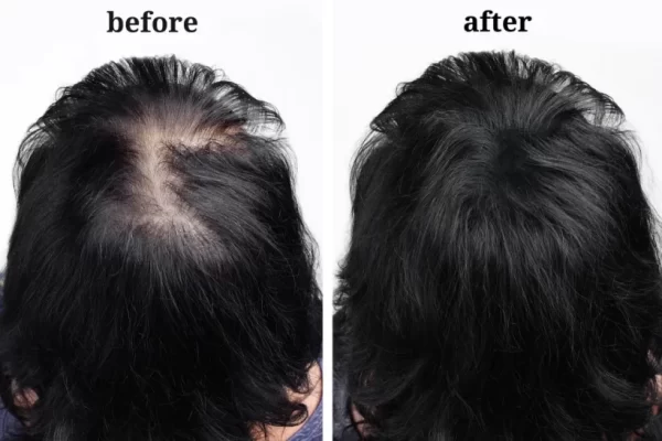 C4 H COLLAGEN للحفاظ على لمعان الشعر وتألقه الداخلي الطبيعي.يحسن كثافة الشعر ويحارب تساقط الشعر. يجدد مستويات الكولاجين