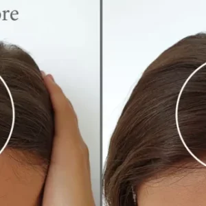 Alternative view of فوركابيل لوشن تقوية و علاج تساقط الشعر FORCAPIL HAIR LOTION