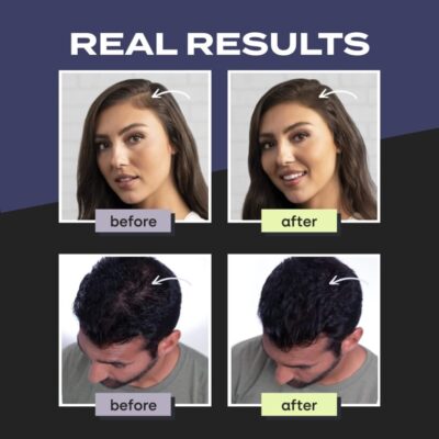  Mirage Hair Building Fibers الياف الكيراتين الطبيعي لبناء الشعر تحسين مظهر الشعر الخفيف والمتضاءل وتغطية مناطق الصلع.