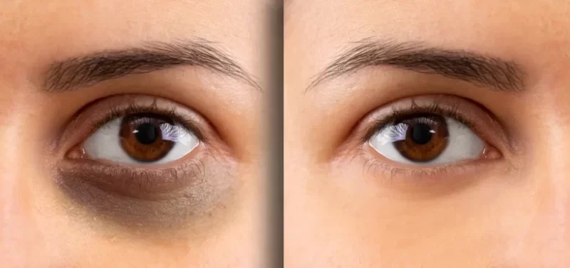  IMAGE AGELESS كريم العين مصمم للعناية بمنطقة العين.يعمل على مكافحة علامات الشيخوخة مثل الهالات السوداء، الانتفاخات والتجاعيد حول العينين.