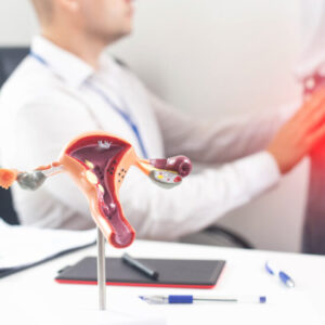 Alternative view of ميو بلس مكمل غذائي لدعم الخصوبة عند النساء Myo Plus