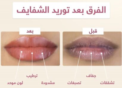 ⁦بيوتي سي كريم كولاجين توريد الشفايف 20جم Beauty C⁩ - الصورة ⁦5⁩