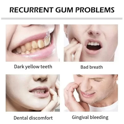 Alternative view of Astera غسول الفم 6 في 1خالٍ من الكحول DIAMOND