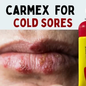 Alternative view of carmex مرطب شفاه كارمكس خوخ و مانجو 10 جرام
