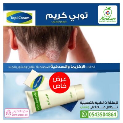 كريم اليوريا توبي كريم مرطب للاكزيما و الصدفية و الوردية TOPI CREAM